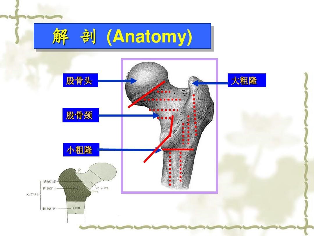 常见四肢骨折分型汇总，图文结合轻松掌握！-德医学院-助力医学教育发展！